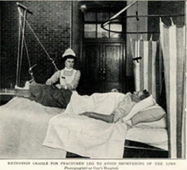 Guys Hospital c1915.  1.  X..png